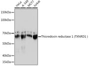 Human Thioredoxin Reductase 1/TRXR1 Rabbit mAb