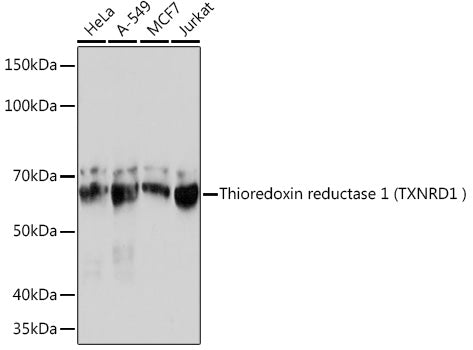 Human Thioredoxin Reductase 1/TRXR1 Rabbit mAb