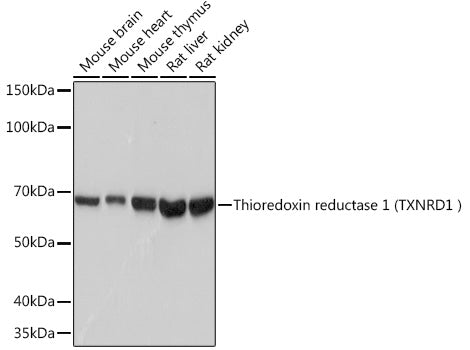 Human Thioredoxin Reductase 1/TRXR1 Rabbit mAb