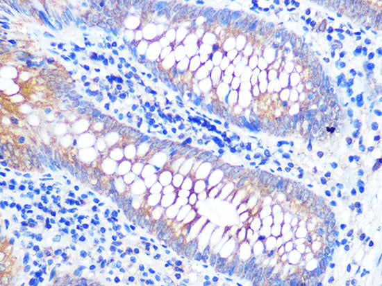 VAMP8 Rabbit mAb