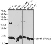 Galectin 1/LGALS1 Rabbit mAb