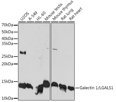 Galectin 1/LGALS1 Rabbit mAb