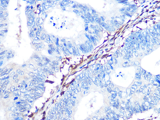 Galectin 1/LGALS1 Rabbit mAb