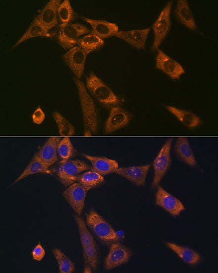 Galectin 1/LGALS1 Rabbit mAb