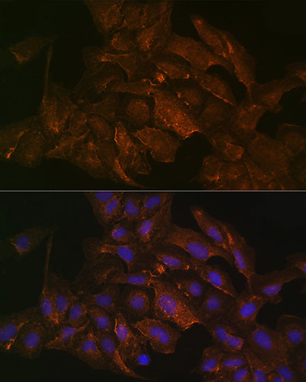 KRAS+HRAS+NRAS Rabbit mAb