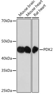 PDK2 Rabbit mAb