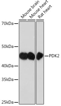 PDK2 Rabbit mAb