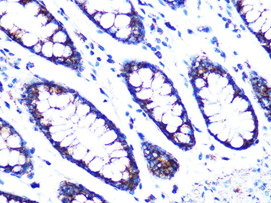 PDK2 Rabbit mAb