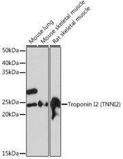 Troponin I2 (TNNI2) Rabbit mAb