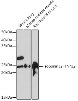 Troponin I2 (TNNI2) Rabbit mAb