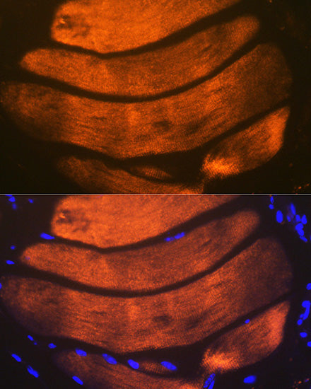Troponin I2 (TNNI2) Rabbit mAb