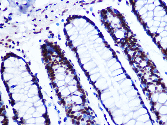 GTPBP4 Rabbit mAb