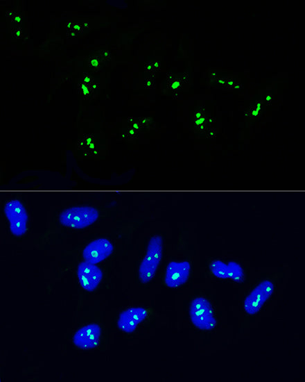 NOP58 Rabbit pAb