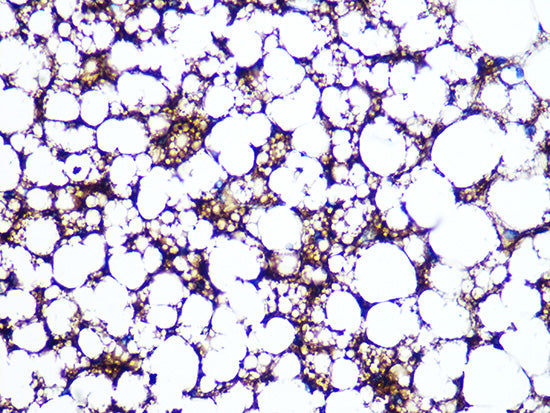 Perilipin A Rabbit mAb