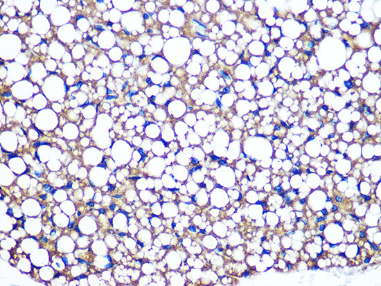 Perilipin A Rabbit mAb