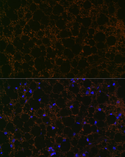 Perilipin A Rabbit mAb