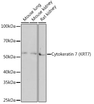 Cytokeratin 7 (KRT7) Rabbit mAb