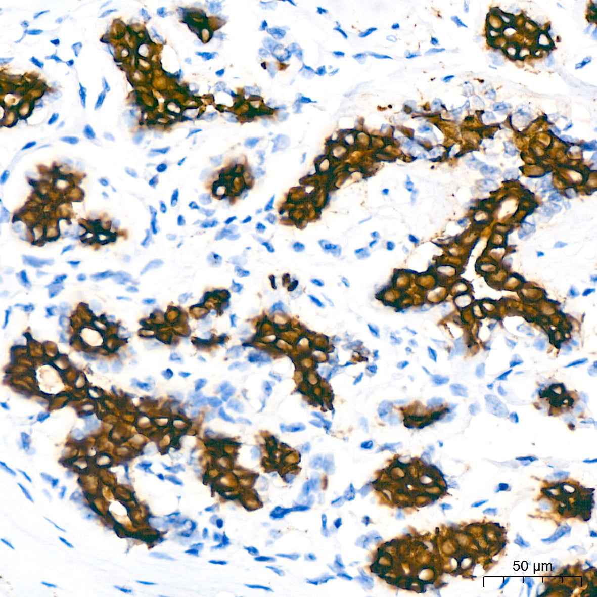 Cytokeratin 7 (KRT7) Rabbit mAb