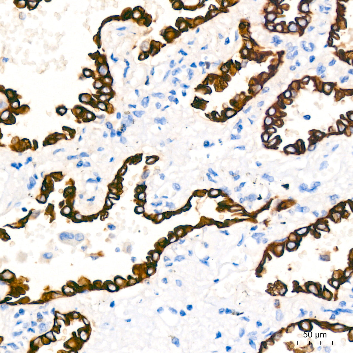 Cytokeratin 7 (KRT7) Rabbit mAb