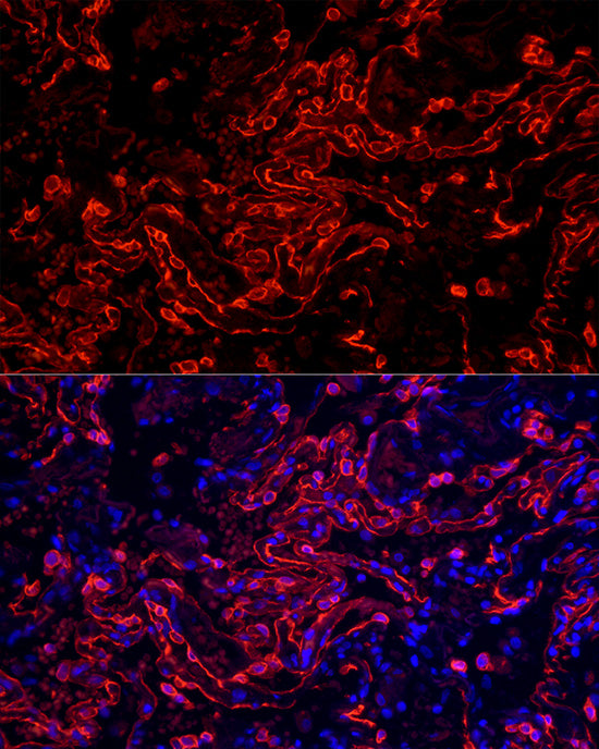 Cytokeratin 7 (KRT7) Rabbit mAb
