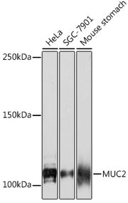 MUC2 Rabbit mAb