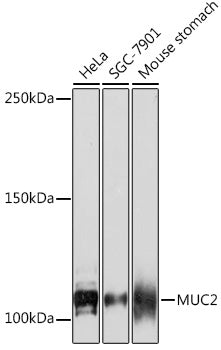 MUC2 Rabbit mAb