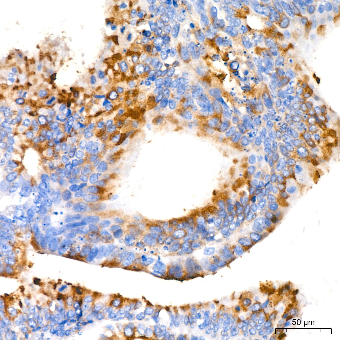 MUC2 Rabbit mAb