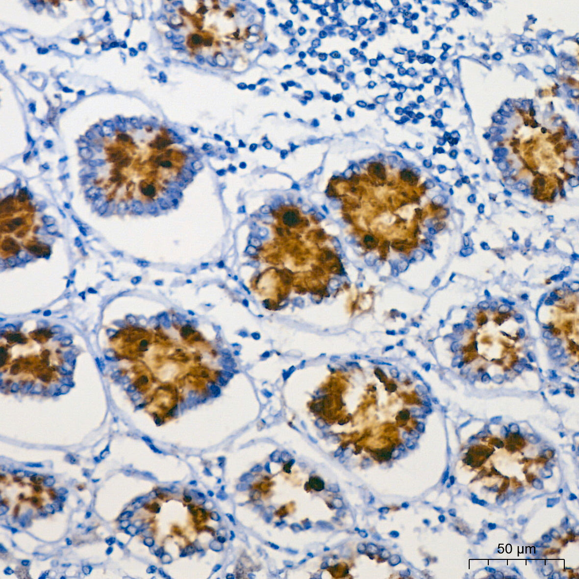 MUC2 Rabbit mAb