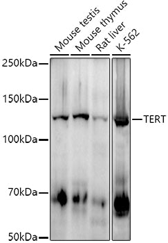 TERT Rabbit mAb