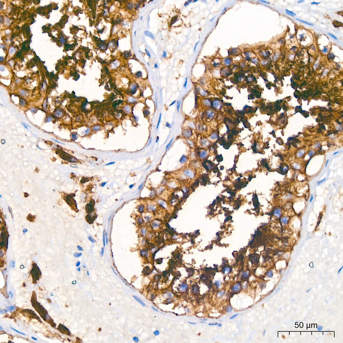 ERK1/2 Rabbit mAb