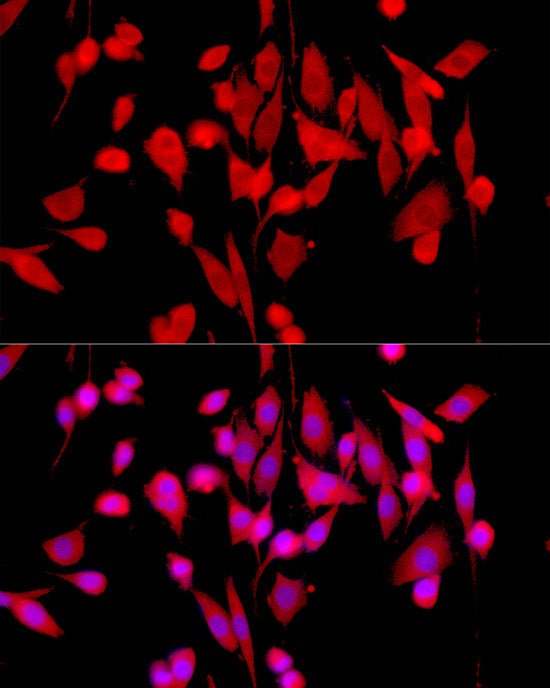 ERK1/2 Rabbit mAb