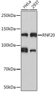 RNF20 Rabbit mAb