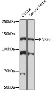 RNF20 Rabbit mAb