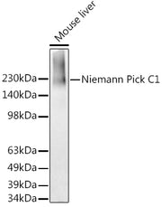 Niemann Pick C1 Rabbit mAb