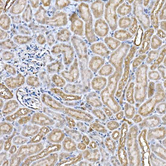 Niemann Pick C1 Rabbit mAb