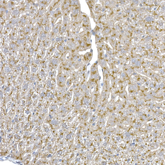 Niemann Pick C1 Rabbit mAb