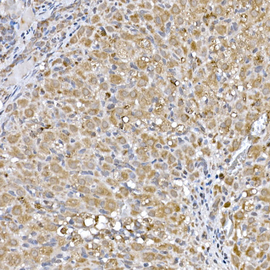 Niemann Pick C1 Rabbit mAb