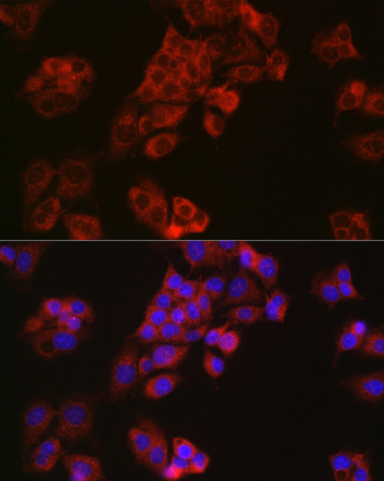 Niemann Pick C1 Rabbit mAb