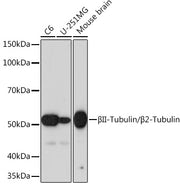 βII-Tubulin/β2-Tubulin Rabbit mAb