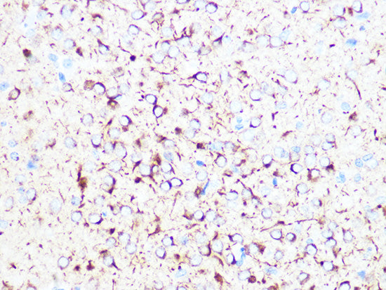 βII-Tubulin/β2-Tubulin Rabbit mAb