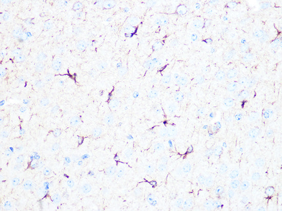 βII-Tubulin/β2-Tubulin Rabbit mAb