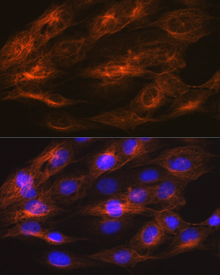 βII-Tubulin/β2-Tubulin Rabbit mAb