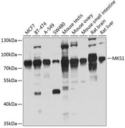 MKS1 Rabbit pAb