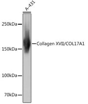 Collagen XVII/COL17A1 Rabbit mAb