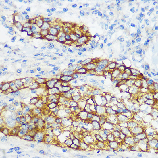 Collagen XVII/COL17A1 Rabbit mAb