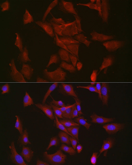 Aconitase 1 (ACO1) Rabbit mAb