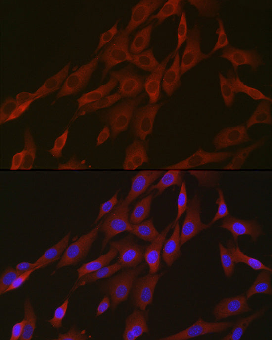 Aconitase 1 (ACO1) Rabbit mAb
