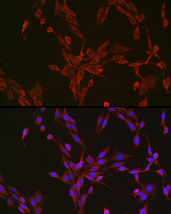 Aconitase 1 (ACO1) Rabbit mAb