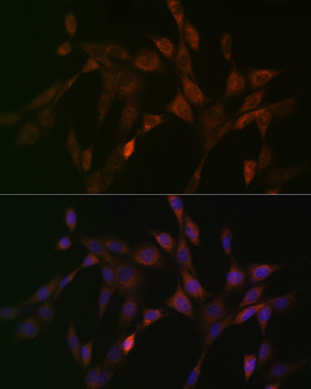 DNAJC15 Rabbit mAb
