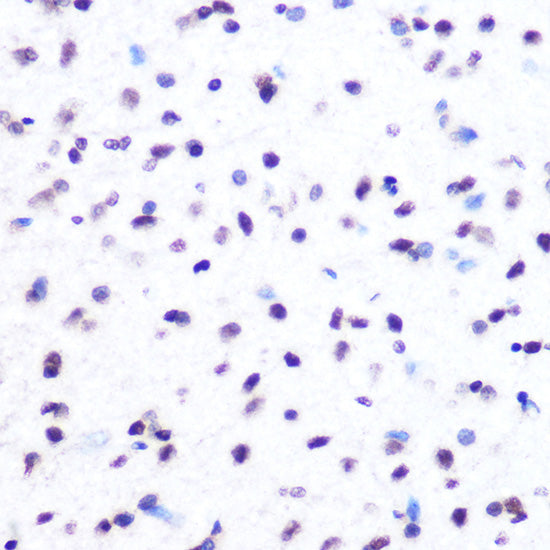 Hydroxyl-Histone H2A-Y39 Rabbit mAb